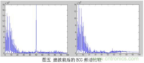 采用MSP430設(shè)計(jì)的12位心電(ECG)放大器